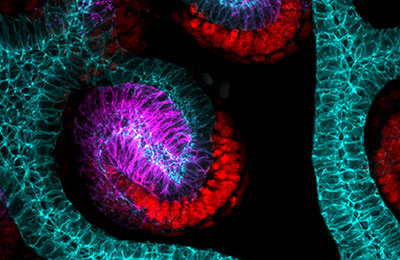 Image showing how the kidney grows specialised structures called nephrons that filter the blood and make urine