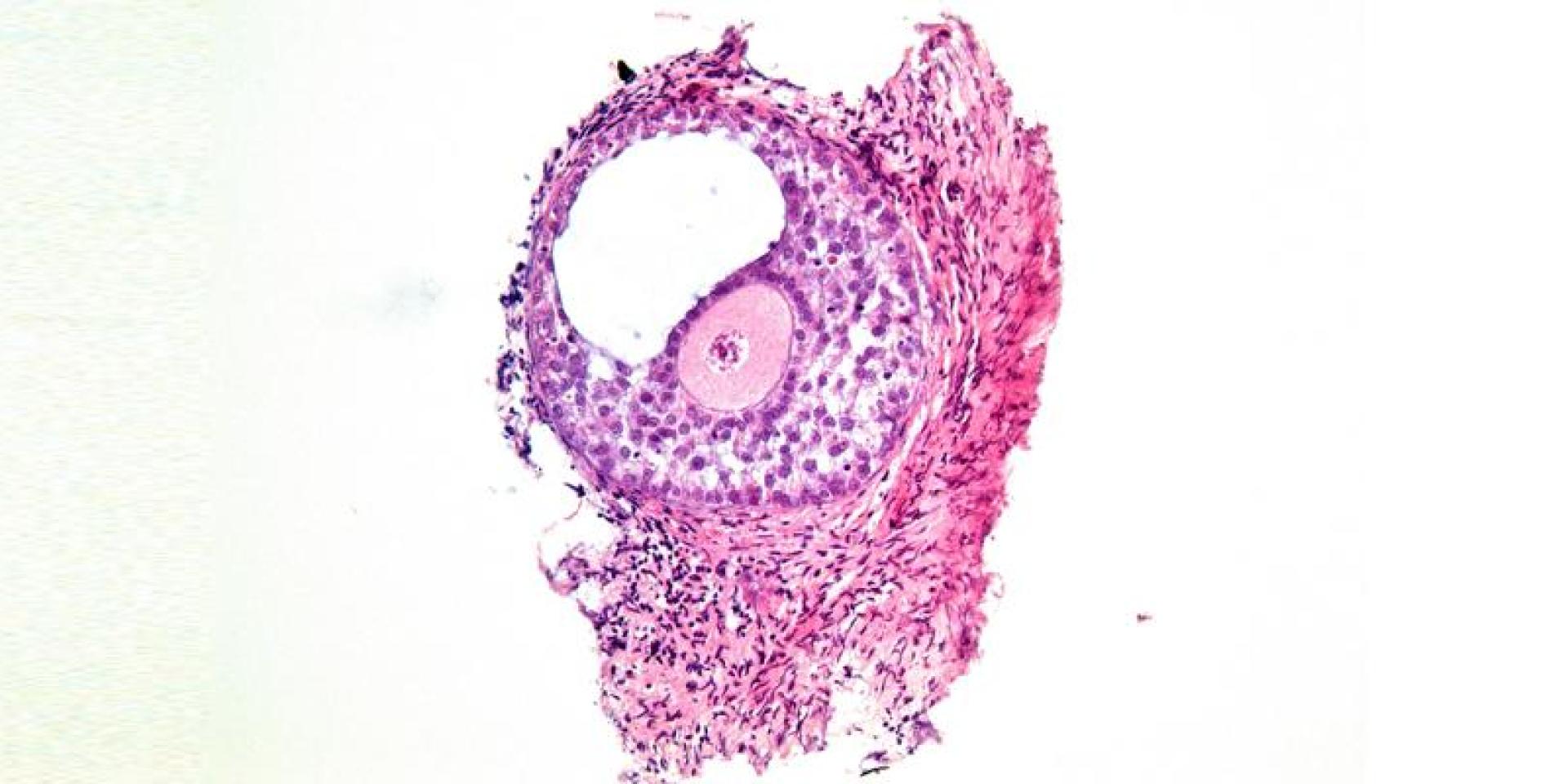 An in vitro grown human ovarian follicle from Professor Evelyn Telfer's lab 