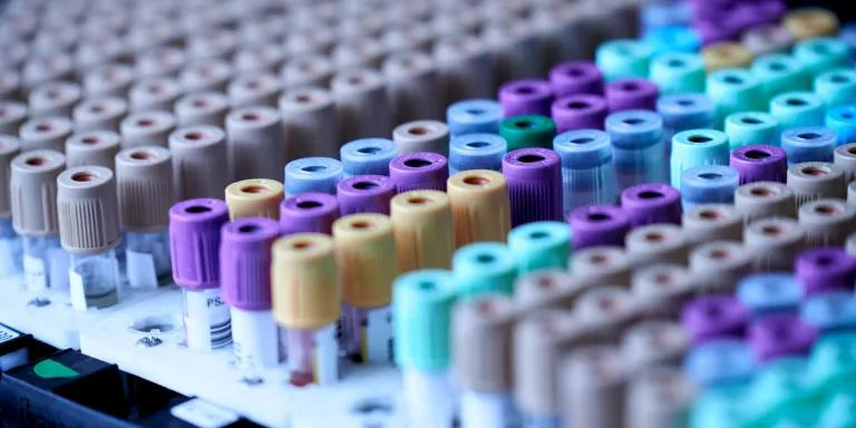 rows of blood test tubes in a rack