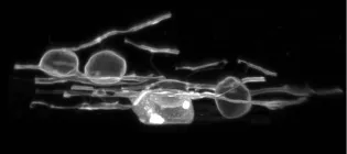 Oligodendrocytes in zebrafish exhibiting the myelin swelling.