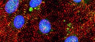 iPSC-derived cardiomyocytes stained for ACTN2 (red), RBM20 (green), and nuclei (blue).