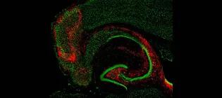 Septal Projections to the Hippocampus which are critical in circuits generating seizures in temporal lobe epilepsy.