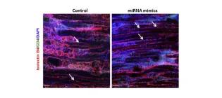 miRNA mimics preserve the native microvasculature network following ischaemic injury