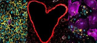 Visualising the vasculature in health and disease