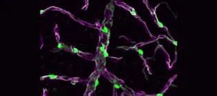 Mouse brain microvasculature by IHC showing pericytes (Atp13a5, green) and basement membrane β-dystroglycan (purple).