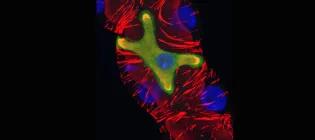 Renal function in Drosophila is executed by the coordinated physiological activities of stellate cells (green) & surrounding principal cells (red).