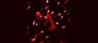 Immune cells living in the brain (red) protect from damage-causing cells (green) by eating them.