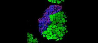 Immune cells (red and blue) clustering on fat cells (green)