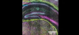 A section through hippocampus showing non-overlapping expression of eEF1A1 and eEF1A2