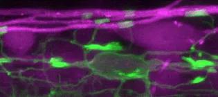 Image of a fluorescent oligodendrocyte (green) making myelin sheaths that wrap around axons (magenta) in a living zebrafish.