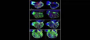 Confocal images of Tg(myl7:EGFP) zebrafish larval heart ventricle during development. Hpf-hours post-fertilization, BA-bulbus arteriosus, V-ventricle.