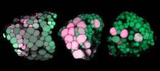 Fat droplets in zebrafish.