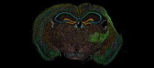 Xenium spatial transcriptomics showing cellular heterogeneity and glial changes in white matter and thalamus after experimental cortical stroke.