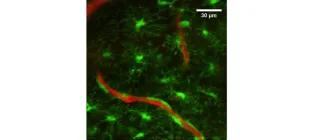 Image of immune cells (green)  in relation to  brain blood vessels (red)  (generated using 2photon microscopy by Dr. Koudelka)