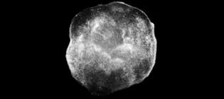 Cortical organoid with integrated oligodendrocytes expressing MBP