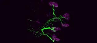 Image of a neuromuscular junction from a mouse model of spinal muscular atrophy.