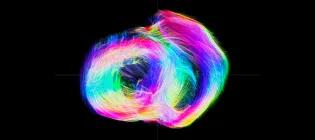 This is a picture of the muscle fibres in a horse's heart, made from MRI scans of the movement of water molecules.