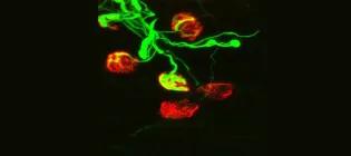 Neuromuscular junctions from a mouse model of motor neuron disease showing degeneration.