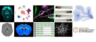 MS Society Edinburgh Centre for MS Research