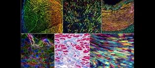 This mosaic image highlights some of the tools that our laboratory uses to study the cells in the heart, in healthy and diseased states.