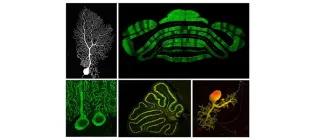 Images of the cerebellum and Purkinje cells, the principal neuron of the cerebellar cortex.