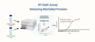 RT-QuIC detects abnormal proteins linked to brain diseases. A rising light signal indicates their presence, supporting early and accurate diagnosis
