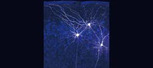 Neurons in the medial entorhinal cortex, a brain region important for spatial cognition and memory.
