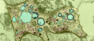 The false colour image reveals a presynapse after activity, with neurotransmitter-containing SVs (pink) and endosomes formed by endocytosis (blue). 