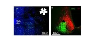 The retina contains many VP-expressing retinal ganglion cells and strikingly, these project exclusively to the core of the suprachiasmatic nucleus.