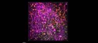 Image of live human brain slice with multicellular labelling