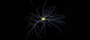 Rat hippocampal neuron at 14 days in vitro (DIV): Camk2a mRNA (orange), MAP2 (cyan).