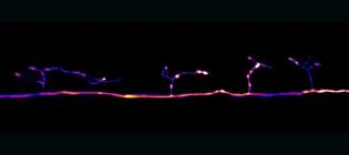 An individual axon in the zebrafish spinal cord.