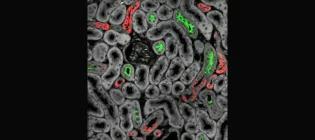 Kidney tubules; different cell types are stained red and green.