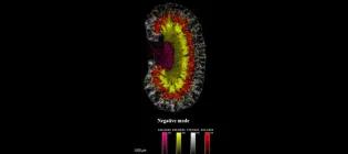 Mass spectrometry image of glucocorticoid and mineralocorticoid hormones that control blood pressure aligned to kidney regions