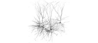 This image shows a group of layer 2/3 cortical pyramidal cells recorded in living human brain tissue.
