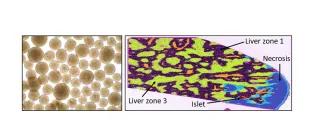 Stem cell-derived islets in culture (left) and after transplantation via the hepatic portal vein into mouse liver (right).