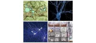 Simons Initiative for the Developing Brain