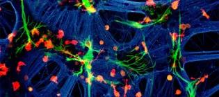 UK Dementia Research Institute at Edinburgh