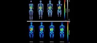 First healthy human whole-body images of [18F]LW223, a new imaging marker of inflammation. Data published in the EJNMMI.