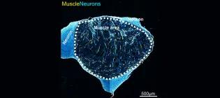 Human Stem cell derived neuromuscular organoids.