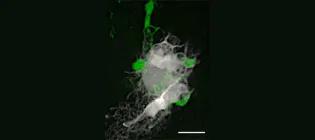 Microglia (green) interacting with brain tumour initiating cells (white).