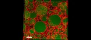Fat body, the fly equivalent of the mammalian liver and adipose tissue, with lipid droplets in green and the ALS8 protein in red.