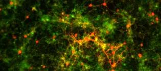 Cultured striatal neurons stained for DARPP32 in red (medium spiny neuron marker) and synaptotagmin in green (pan neuronal marker).