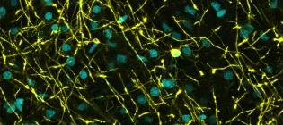 We study how myelin shapes developing brain networks and whether targeting myelin can restore healthy communication in neurodevelopmental disorders.