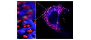 Inter-organelle junctions (green) between mitochondria (red) and the ER (blue) revealed by VAPB molecular complementation.  VAPB is disrupted in ALS8.