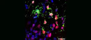 Human oligodendrocytes grown in a dish (green).