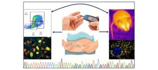 Starting with people with rare type of insulin resistance, we study genes, cells and animal models to work out disease mechanism.