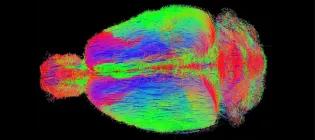 Our approaches: combining behavioural paradigms with brain imaging and cardiovascular monitoring.