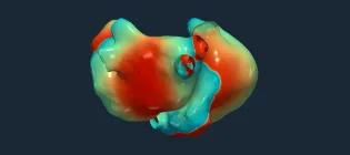 Computer simulation of atrial fibrillation.