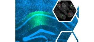 We use genetic, pharmacological, and imaging tools to study brain (e.g. hippocampus, main image, with cell markers, inset) and cognition.